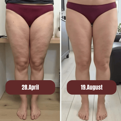 CelluShape - Anti Cellulite 3D Leggings